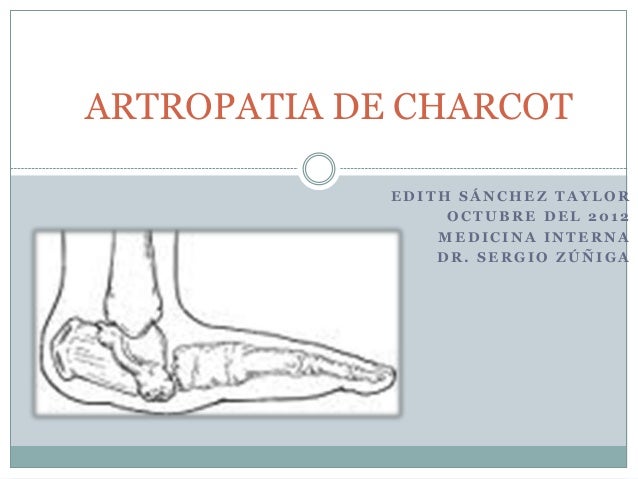 articulacion de charcot